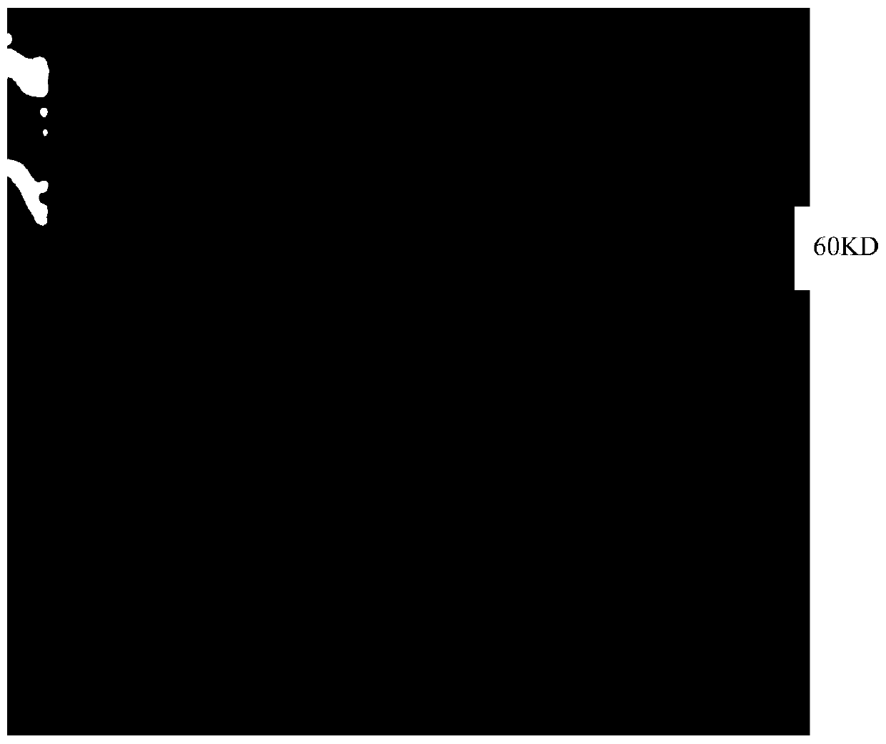 Preparation and application of mycoplasma pneumoniae recombinant antigen