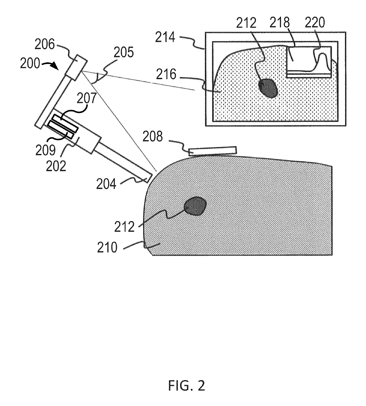 Systems for localization of targets inside a body