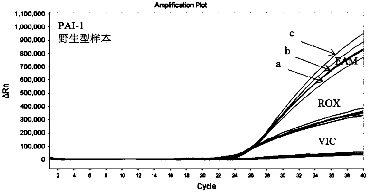 Primer group and kit for detecting polymorphic sites of aspirin-resistant related genes, and application thereof