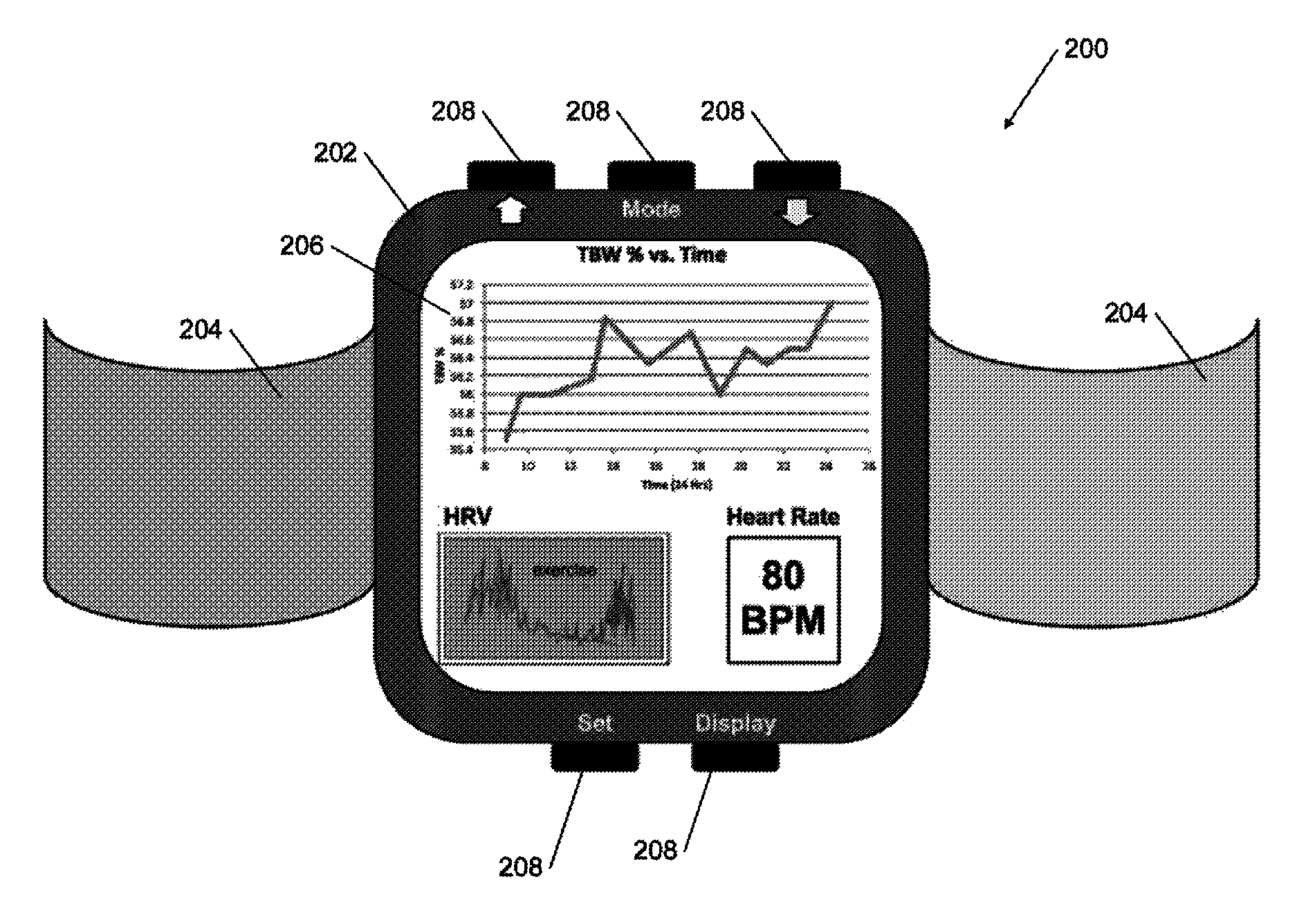 System and method for stress sensing