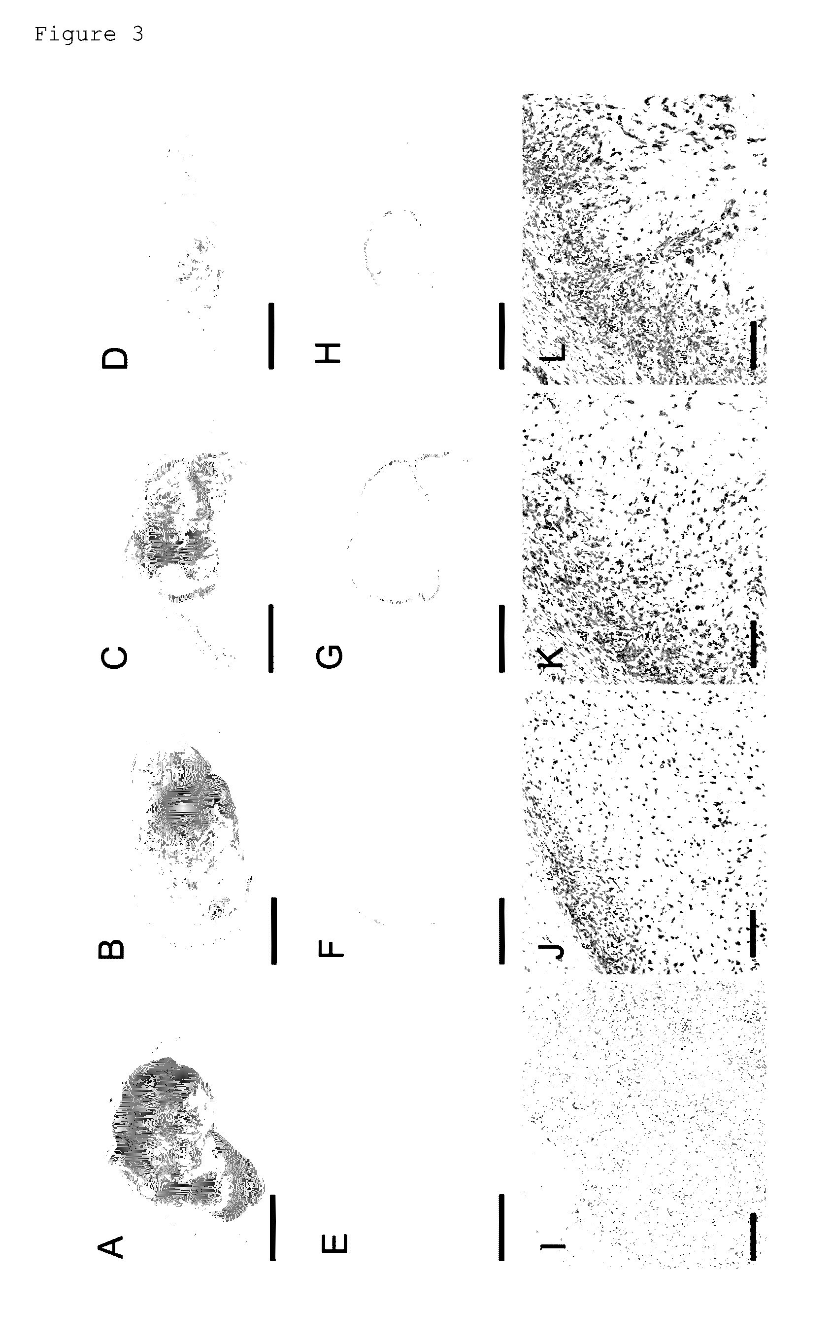 Composition for inducing tumor immunity