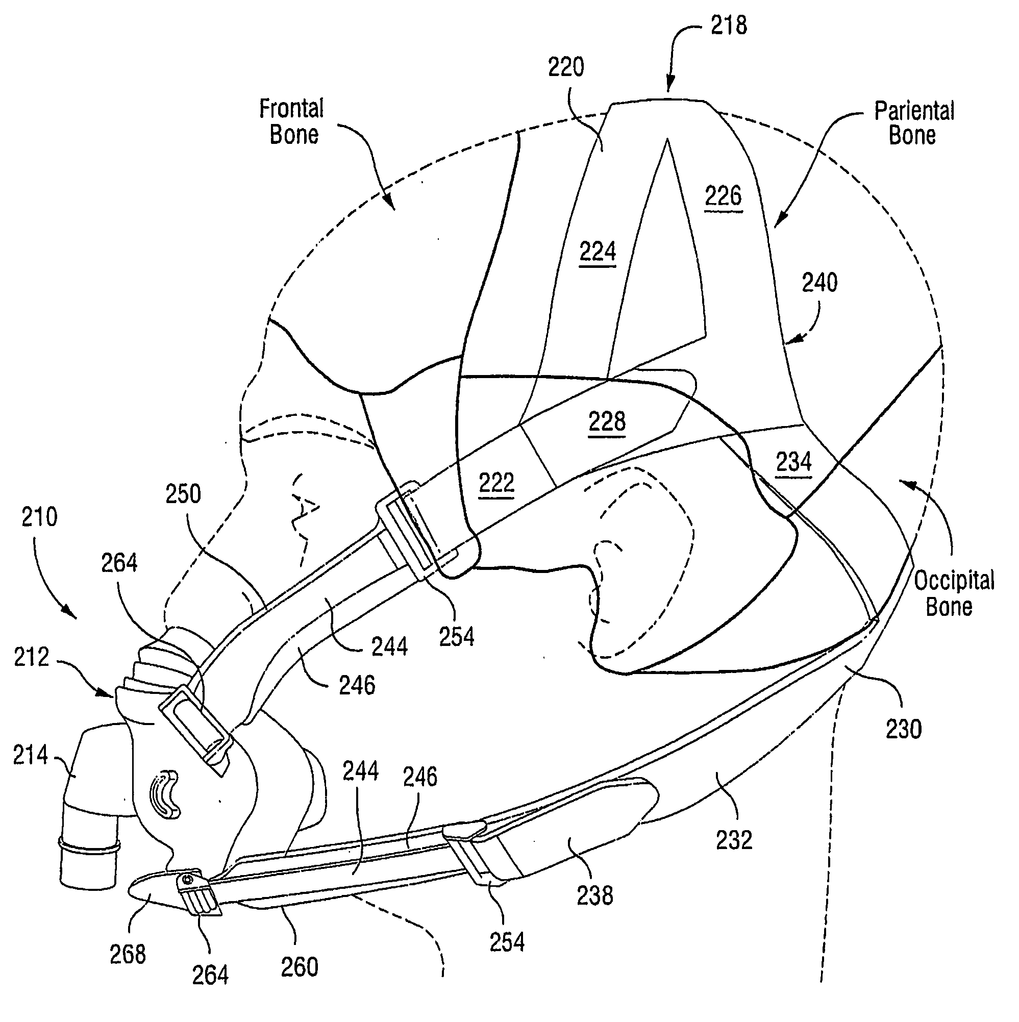 Mask System