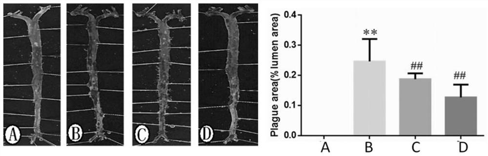 Medicine for treating atherosclerosis and protecting blood vessels, preparation method and application