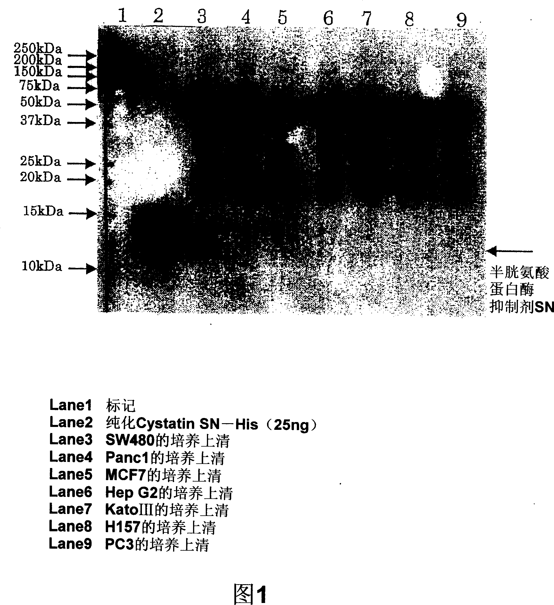 Drug for diagnosing colon cancer and/or colon polyp, observing postoperative course and monitoring reoccurrence