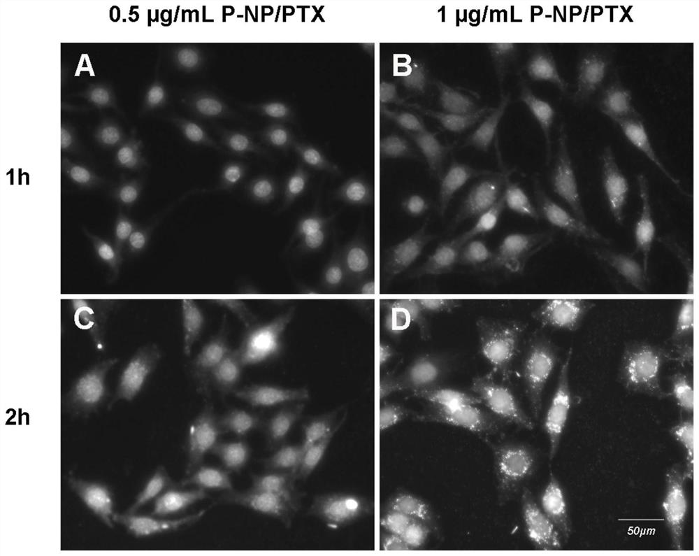 An intelligent drug delivery system regulated by neutrophil extracellular traps in tumor microenvironment and preparation method thereof