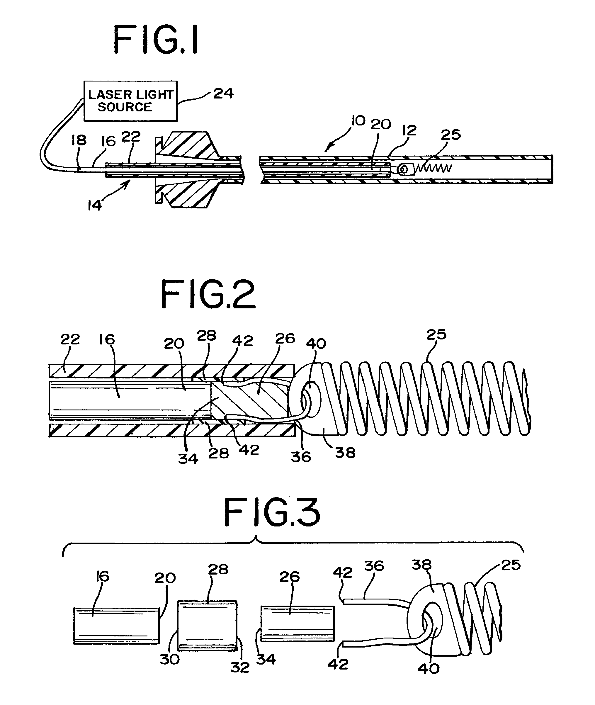 Laser-based vascular occlusion device detachment system