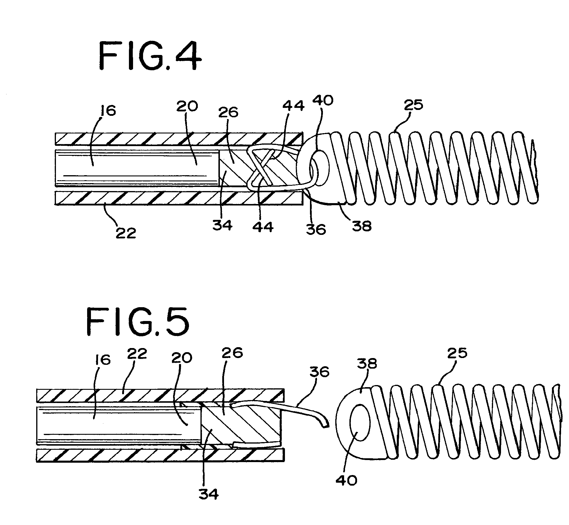 Laser-based vascular occlusion device detachment system