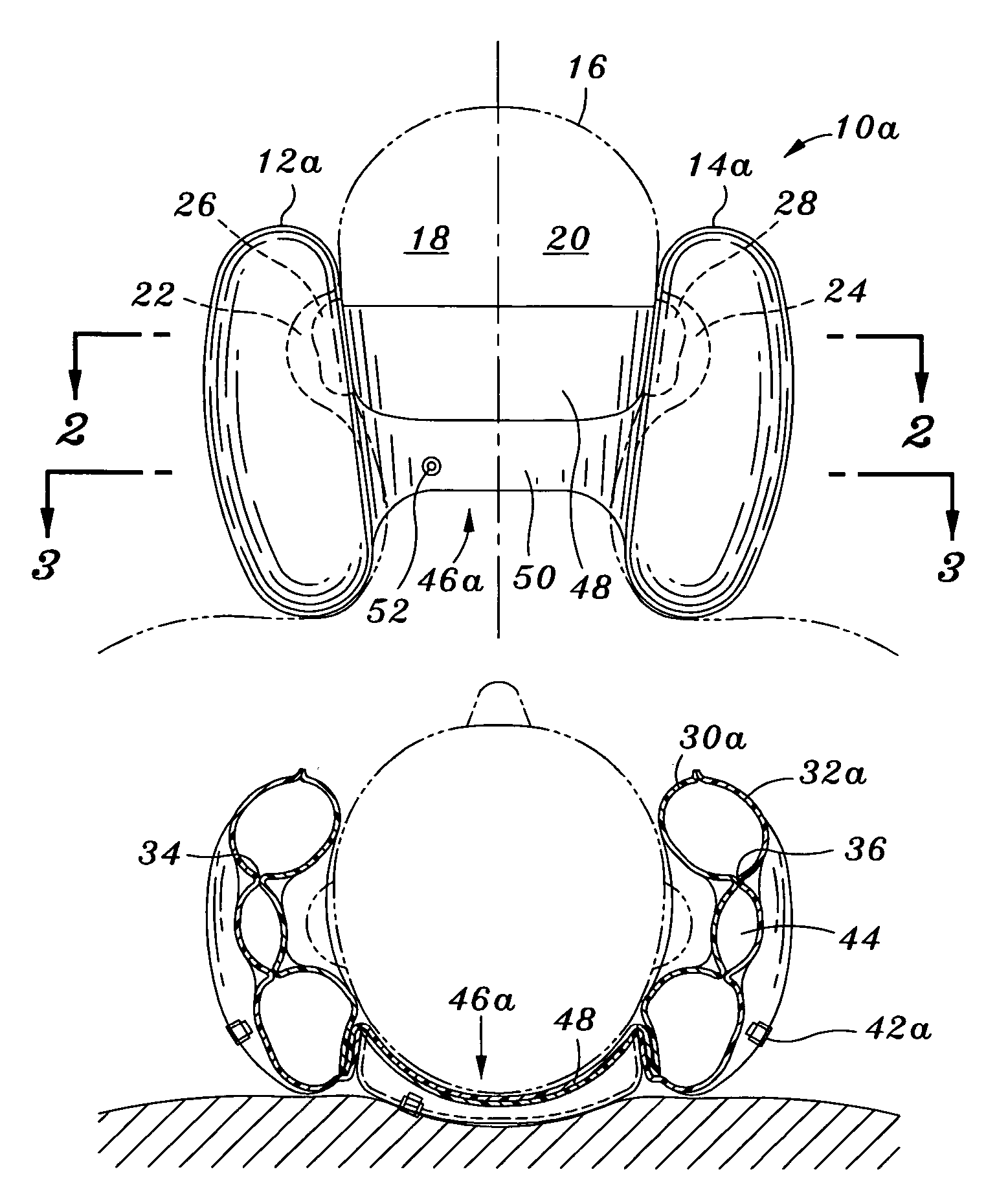 Head rest