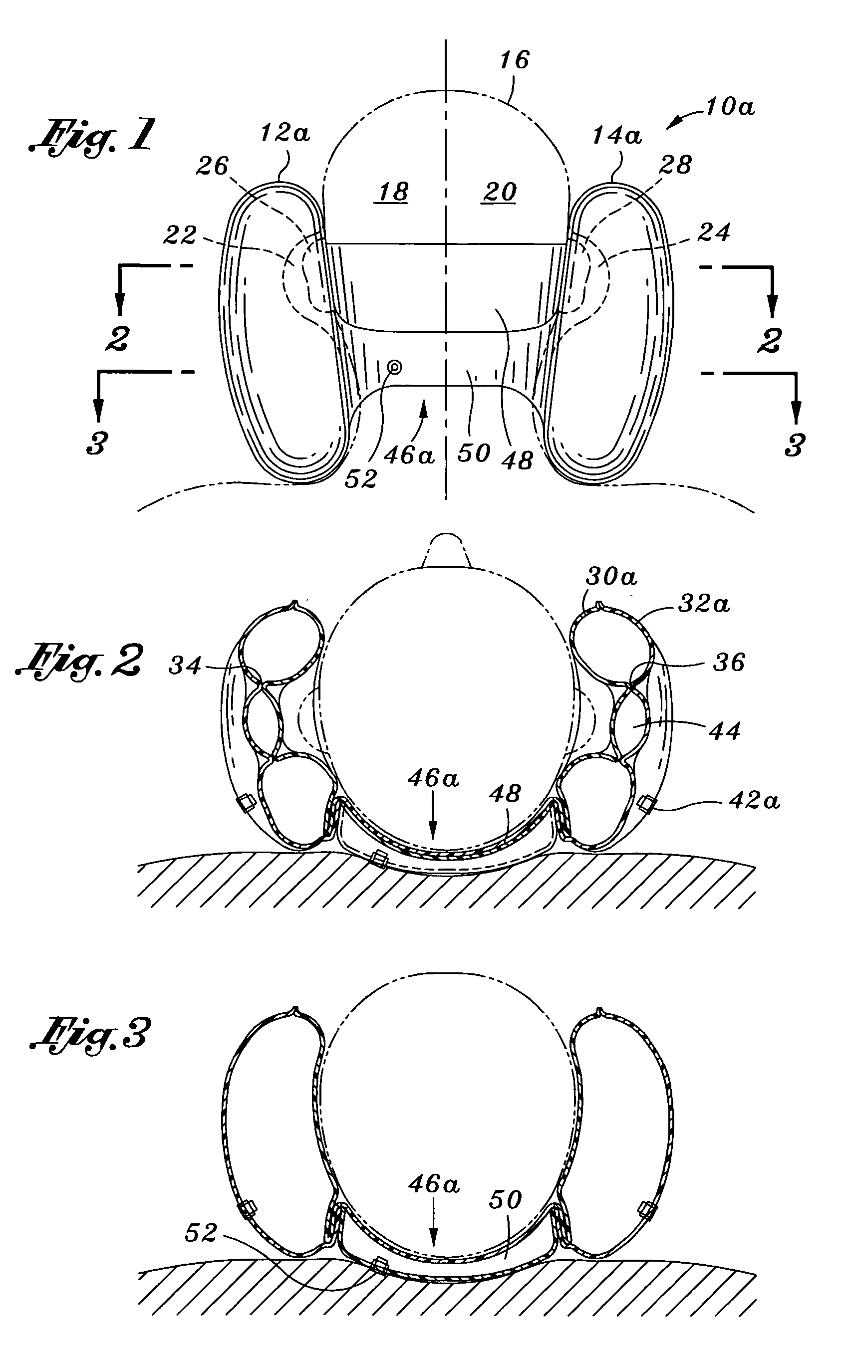 Head rest