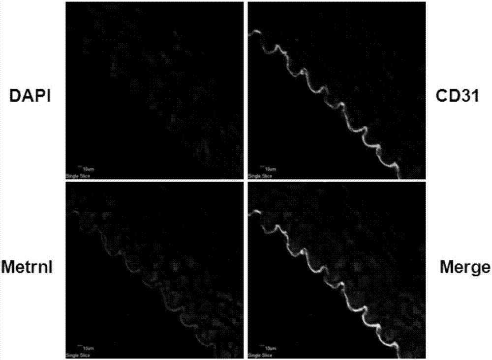 Application of Metrnl protein or gene in treatment of endothelial function impairment