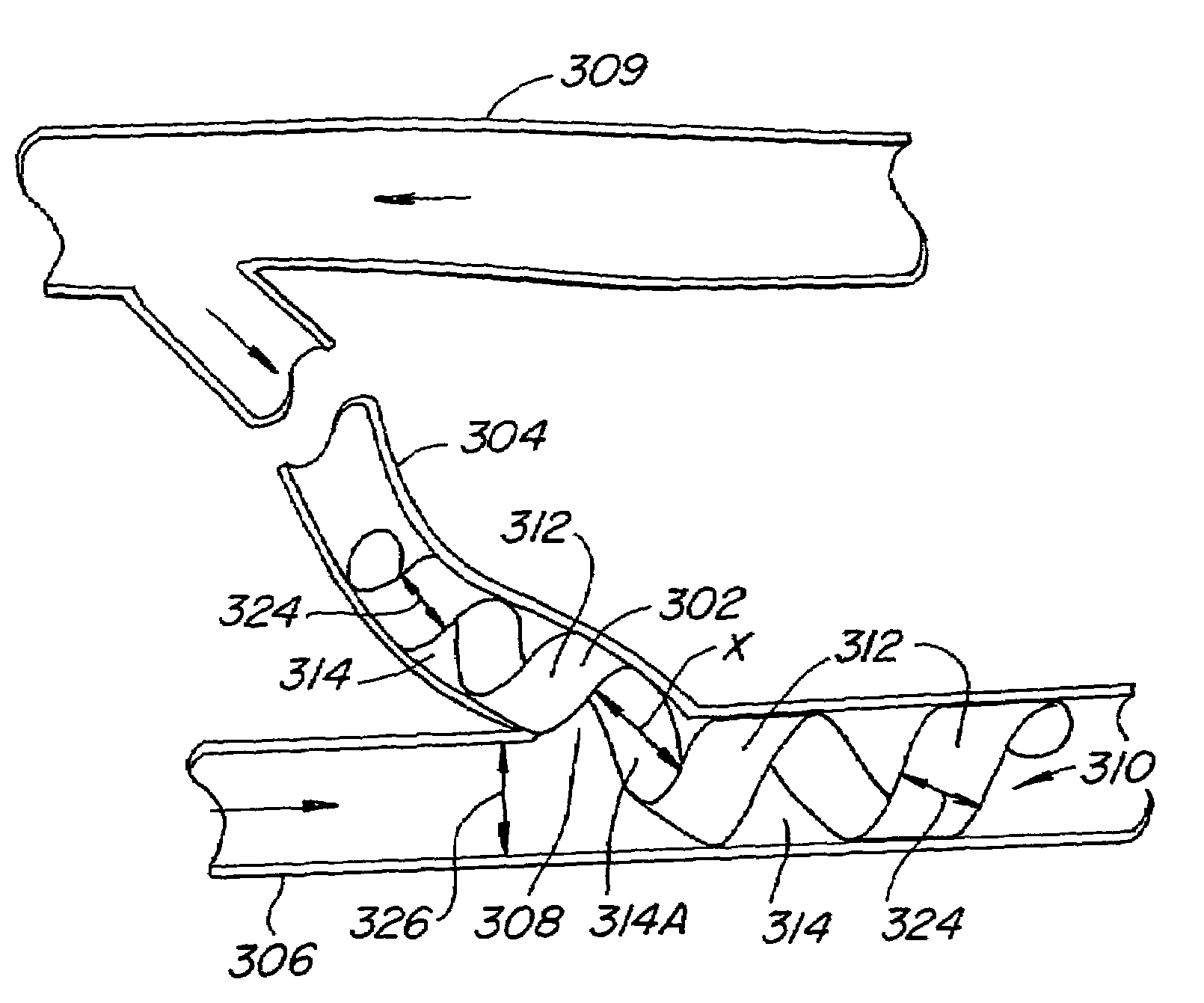 Function-enhanced thrombolytic AV fistula and method