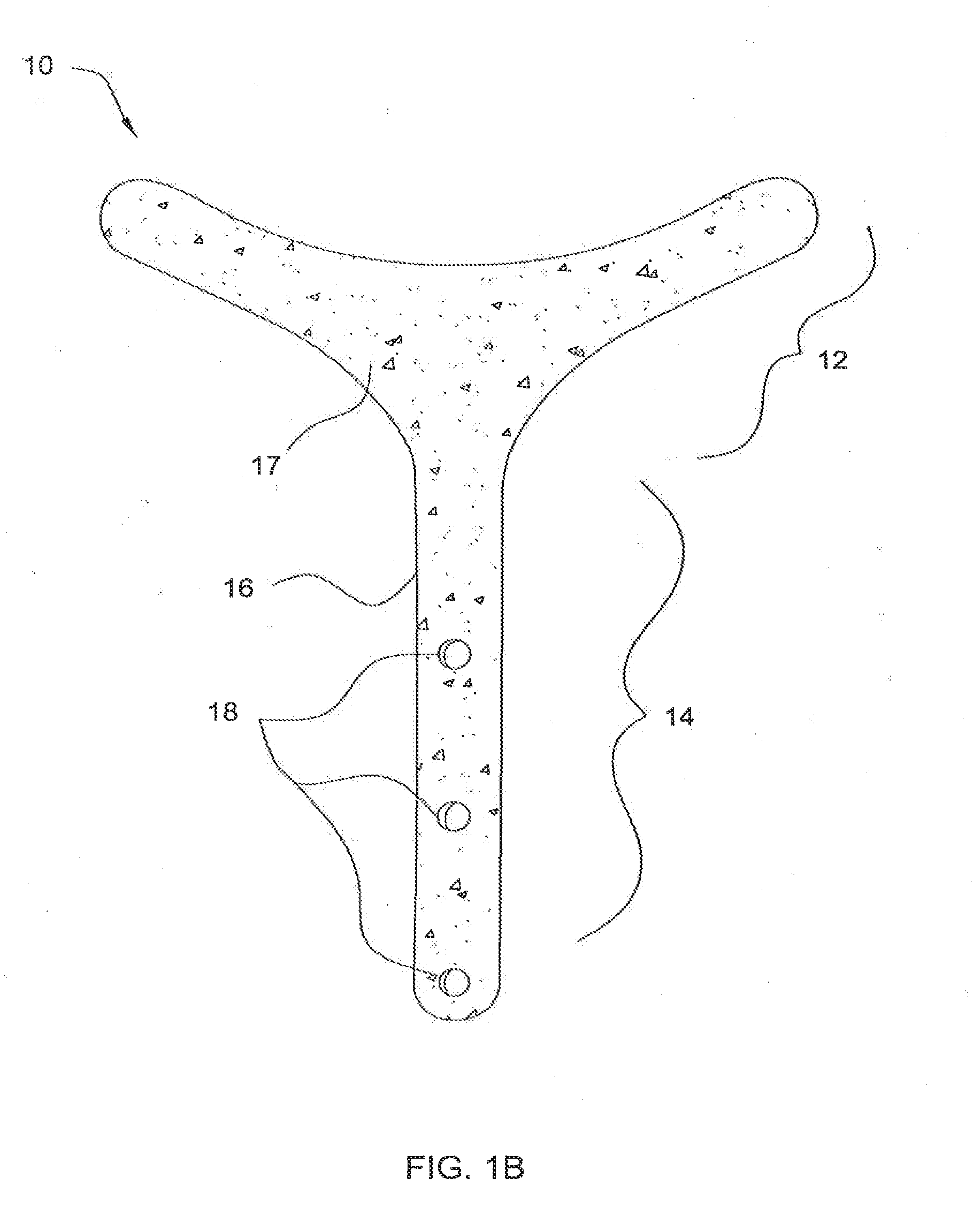 Temporal brow lifting and fixation device