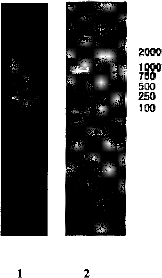 DNA vaccine for preventing and treating cysticercosis cellulosae and preparation method thereof