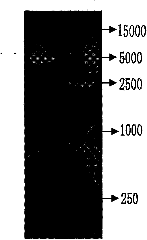 DNA vaccine for preventing and treating cysticercosis cellulosae and preparation method thereof