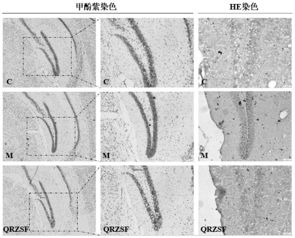 Traditional Chinese medicine composition for preventing or treating diabetic encephalopathy and application thereof