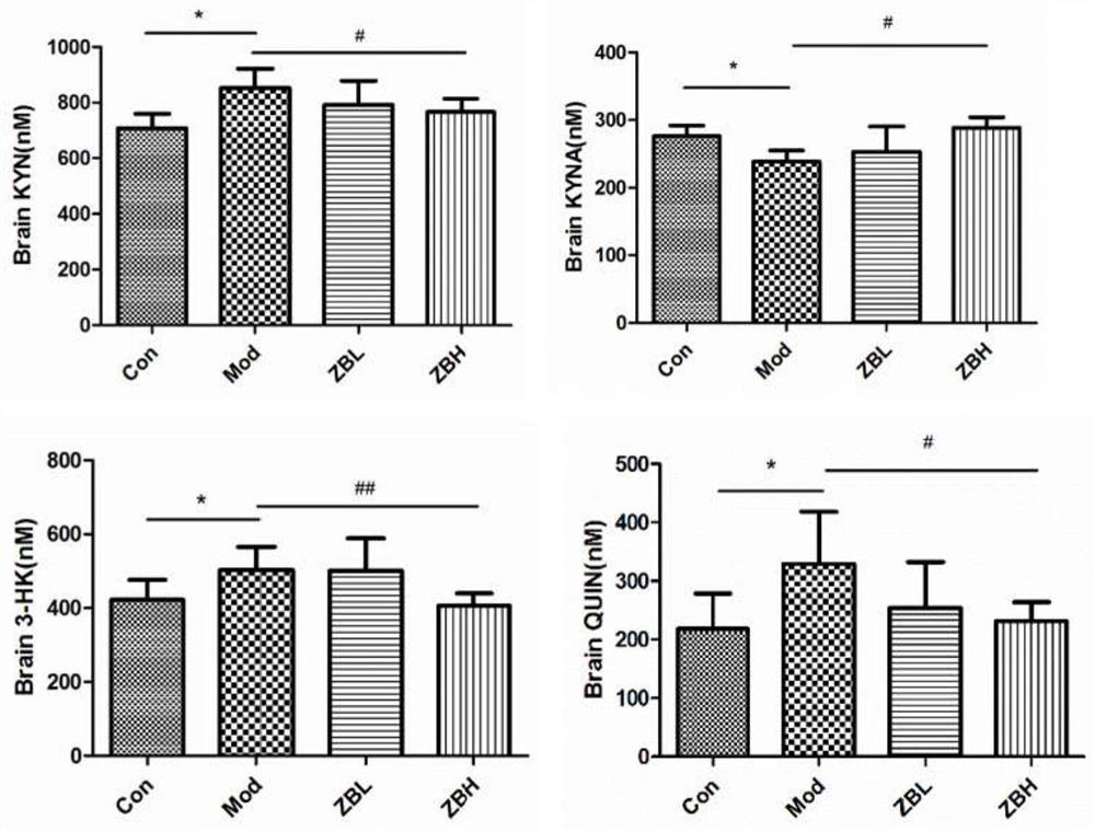 Traditional Chinese medicine composition for preventing or treating diabetic encephalopathy and application thereof