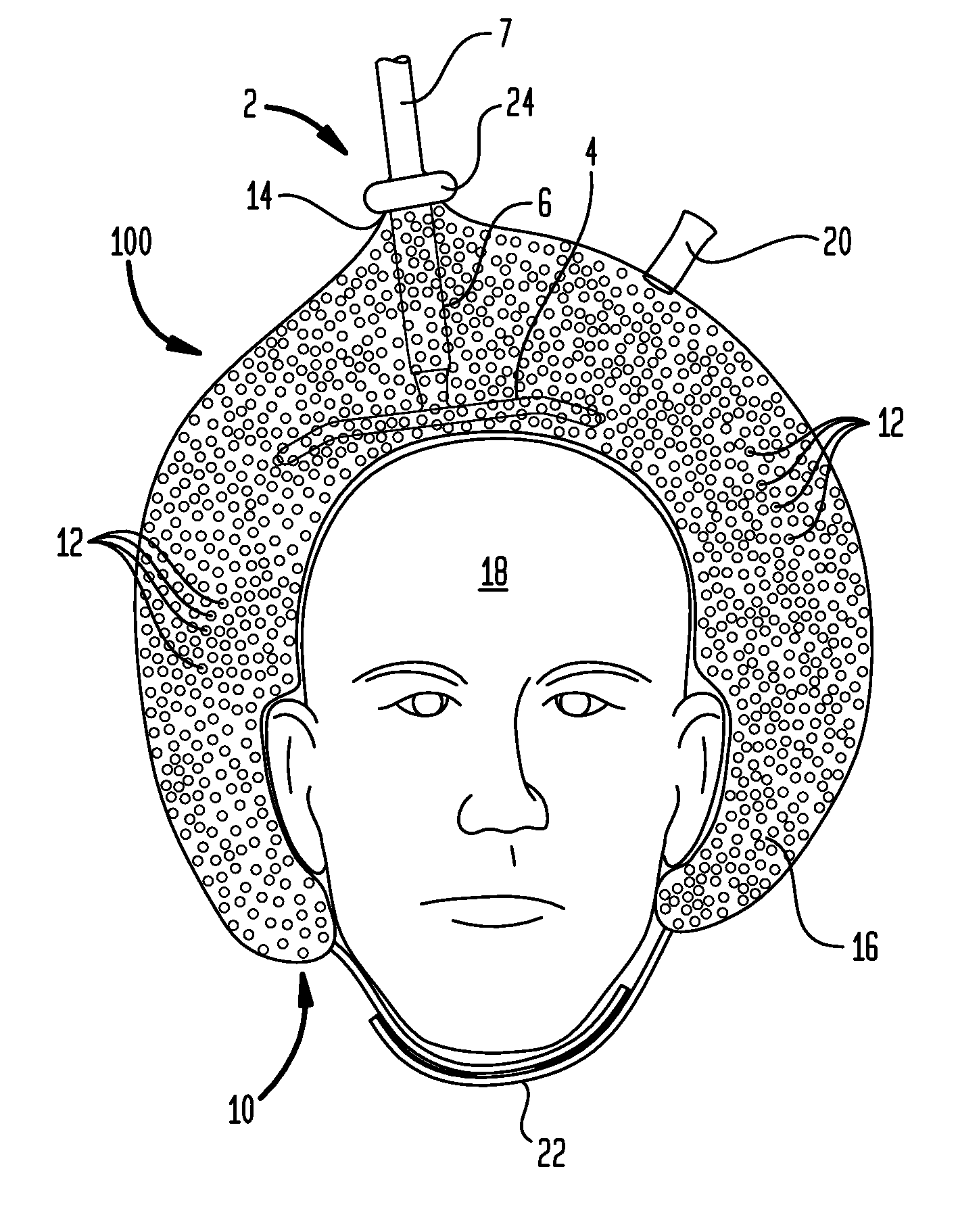 Securing a TMS coil to the patient's head