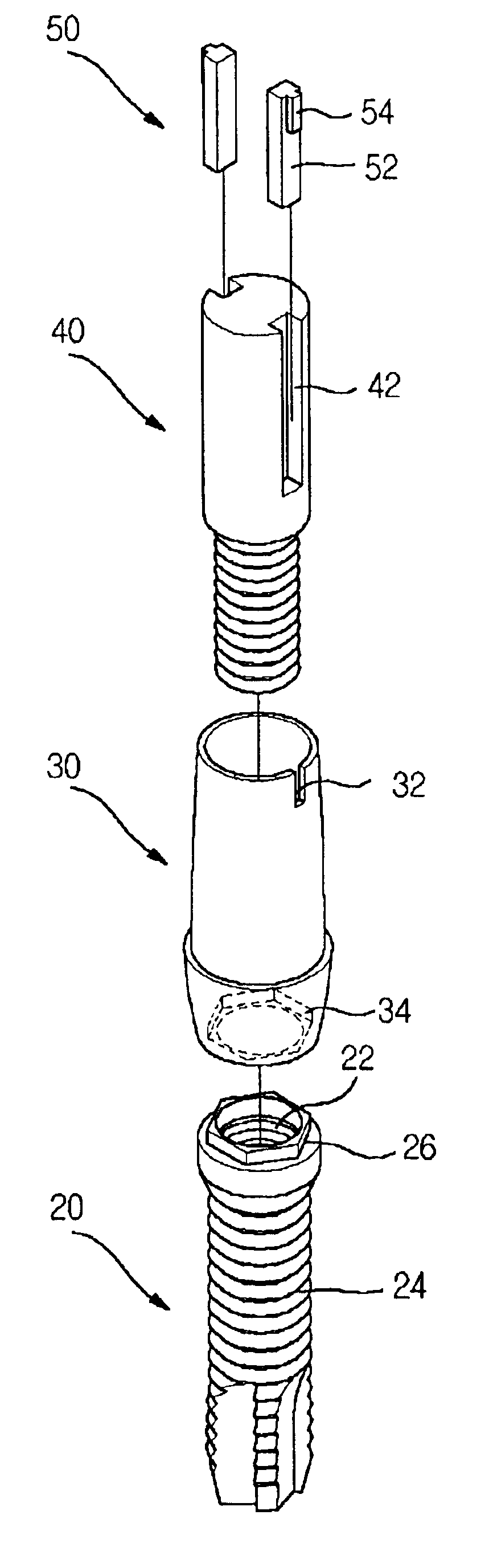 Dental implant structure