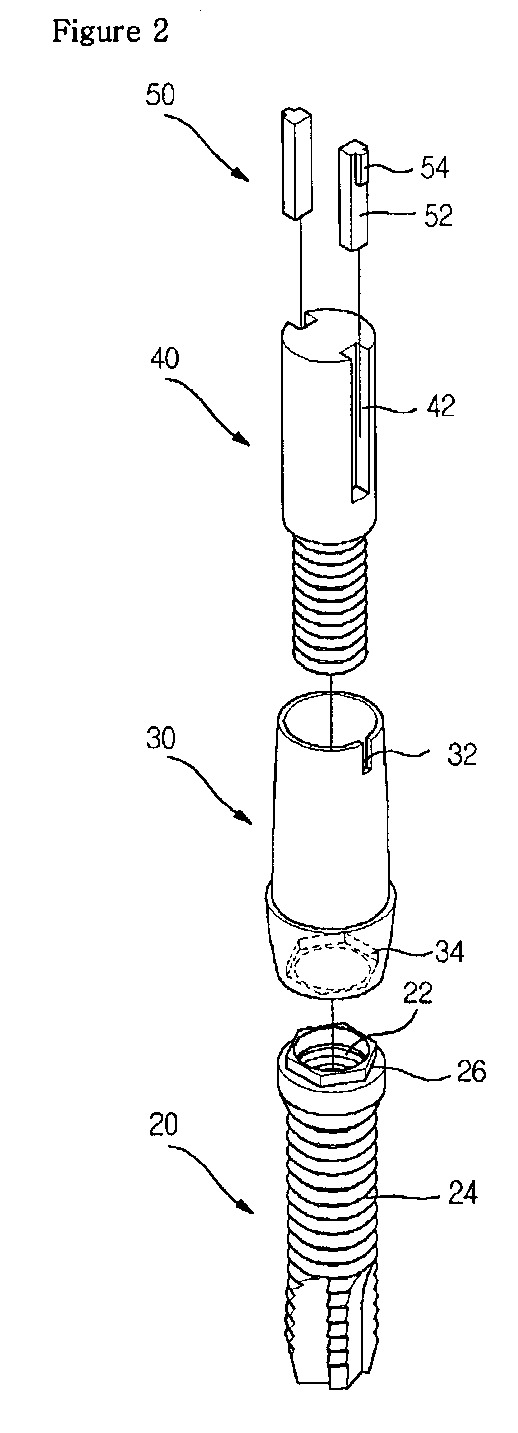 Dental implant structure