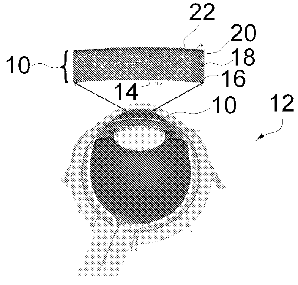 Apparatus and method for endothelial keratoplasty donor tissue transport and delivery