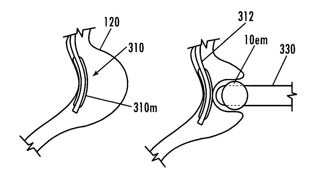 Devices and methods for treatment of obesity