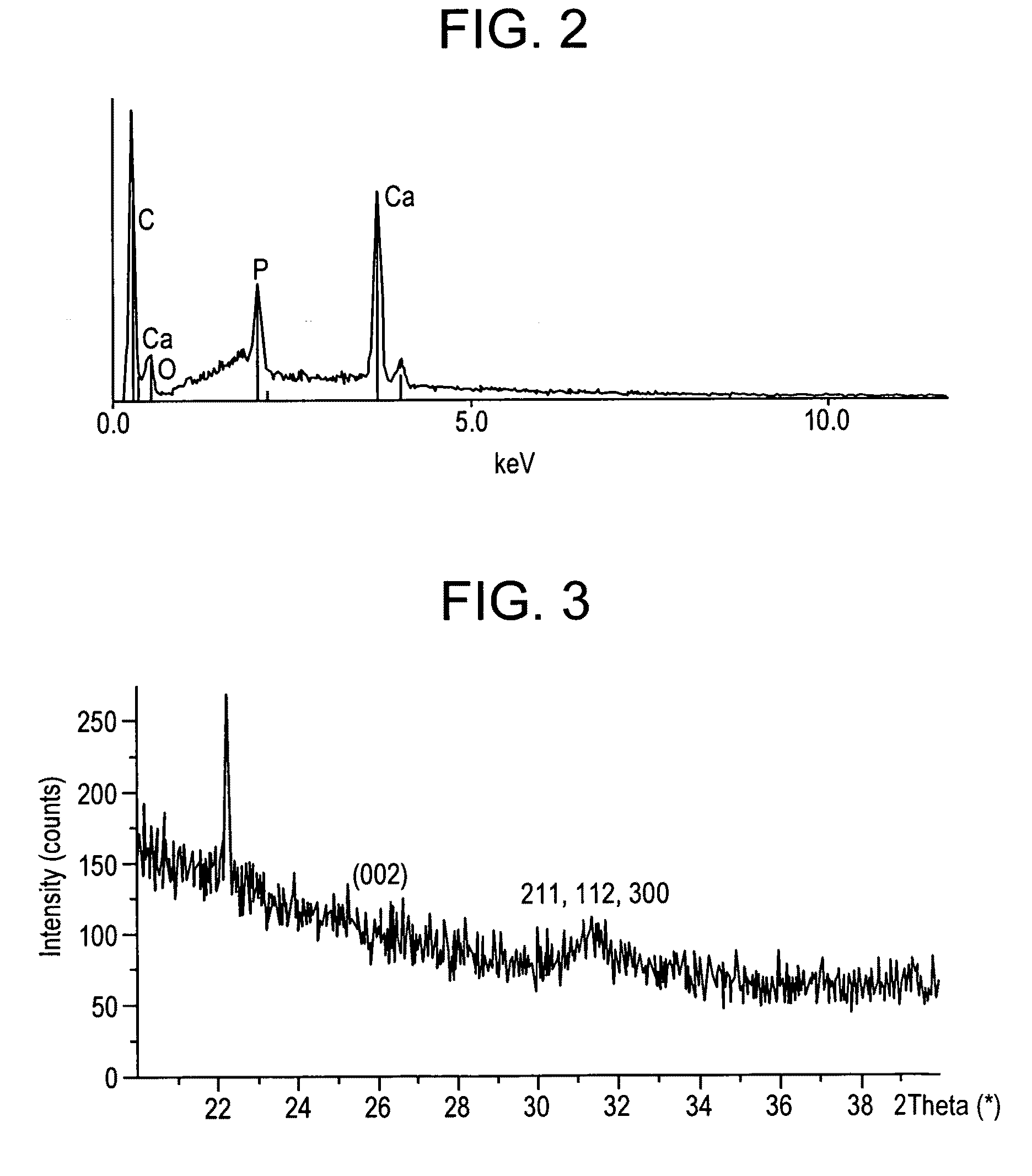 Mineralized guided bone regeneration membranes and methods of making the same