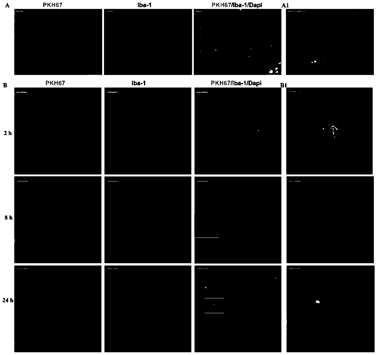 Application of hydrogen sulfide modified bone marrow mesenchymal stem cells (MSCs) extracellular vesicles (EVs) to hypoxic-ischemic brain damage (HIBD)