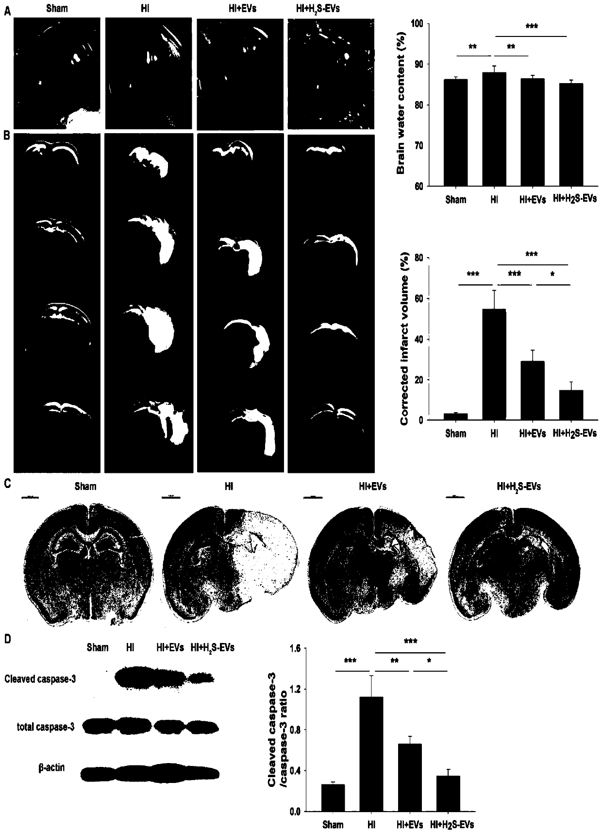 Application of hydrogen sulfide modified bone marrow mesenchymal stem cells (MSCs) extracellular vesicles (EVs) to hypoxic-ischemic brain damage (HIBD)