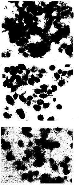 Enzyme-labeling-liquid-based cytology staining kit for screening bladder cancer