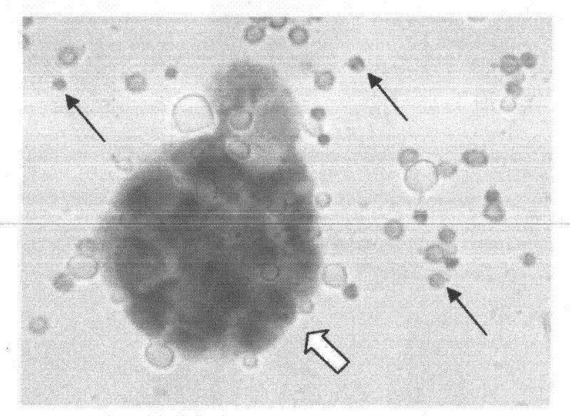 Enzyme-labeling-liquid-based cytology staining kit for screening bladder cancer