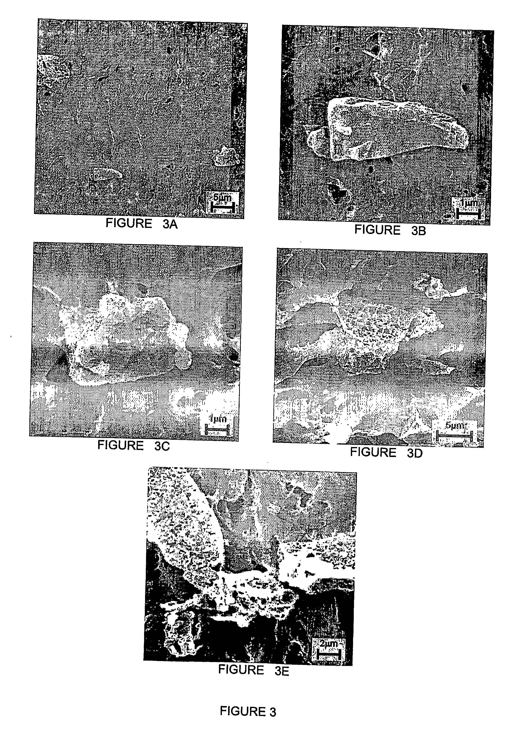 Process and compositions for preparing particulate, bioactive or resorbable biosilicates for use in the treatment of oral ailments