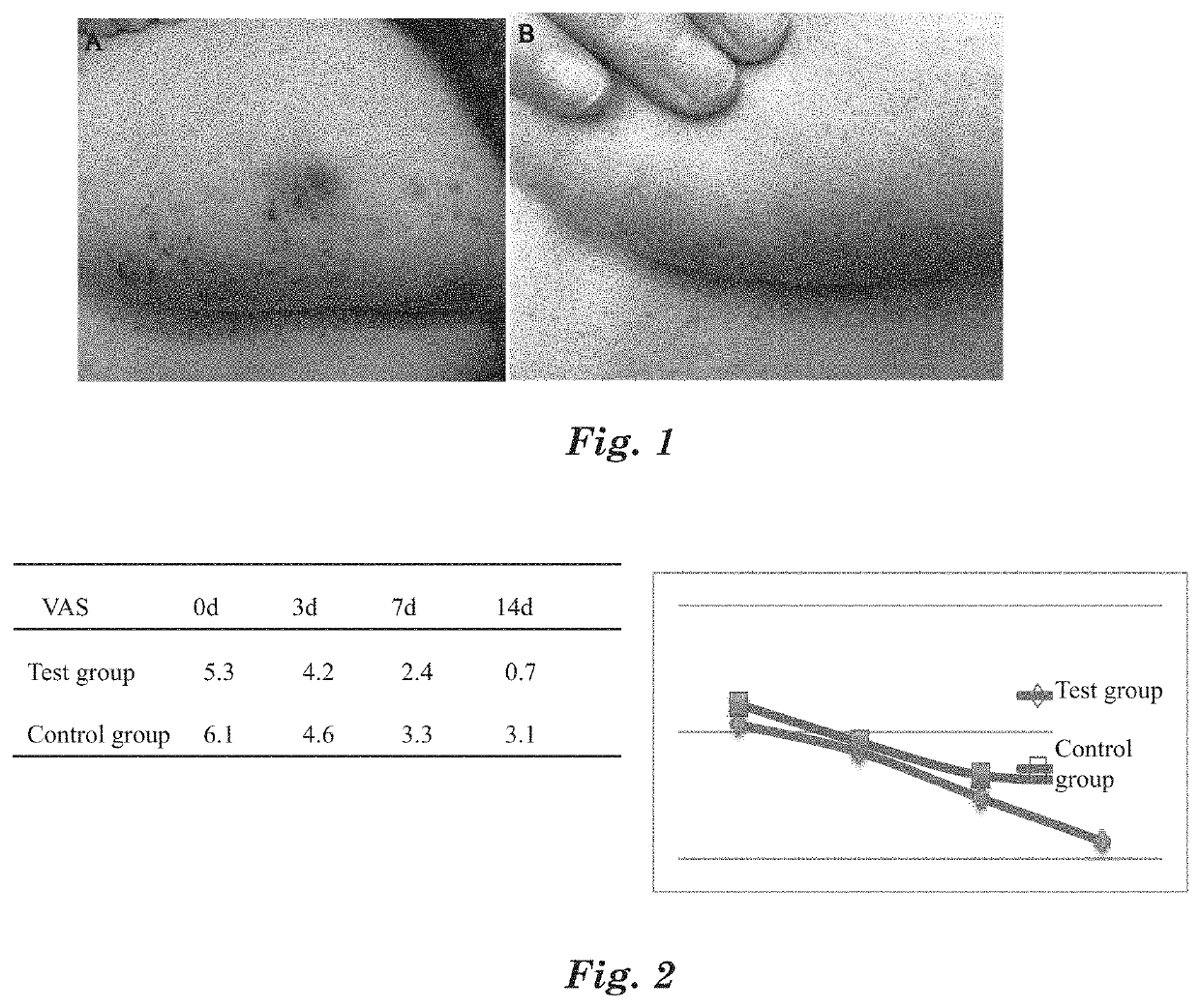 Mussel adhesive protein product and applications thereof in suppression of skin inflammations