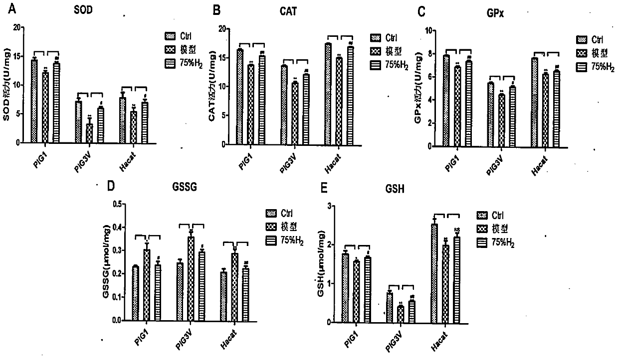 Application of hydrogen to preparing preparation for preventing and curing leucoderma