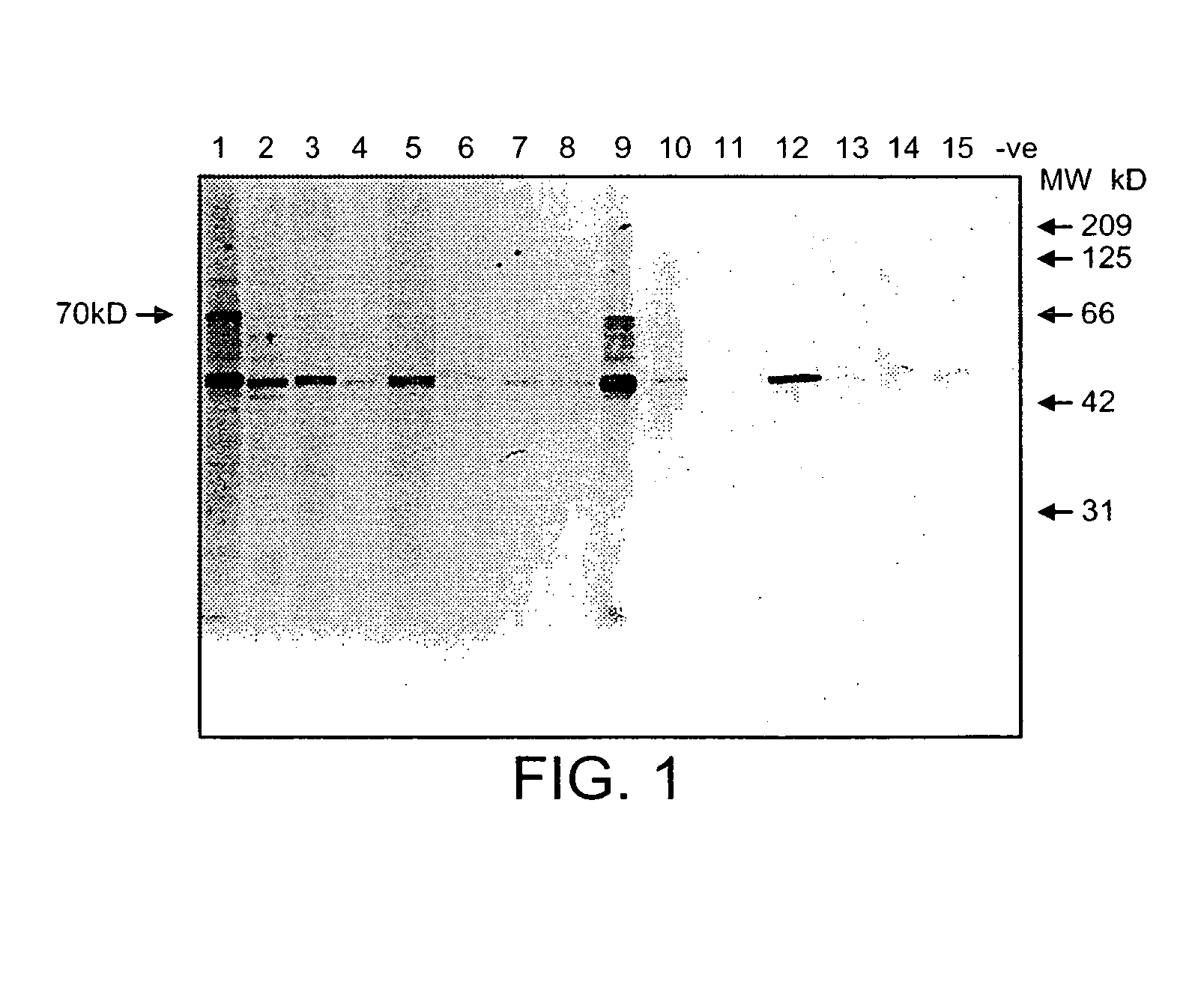 Treatment of inflammatory disease