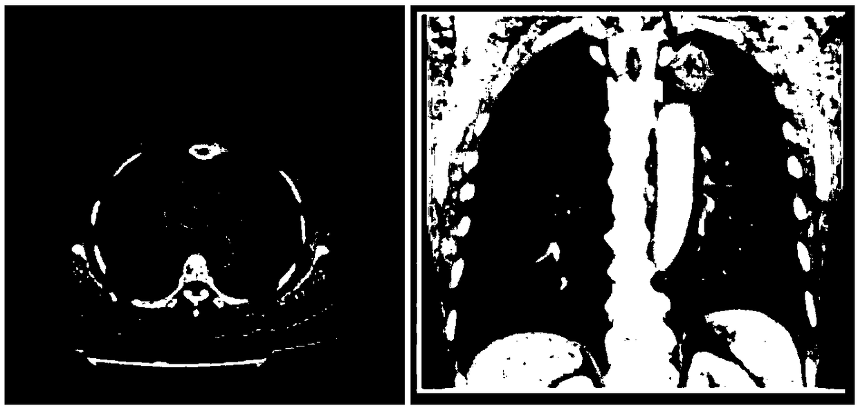 Nodule detection method and device