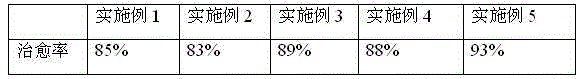 TCM (Traditional Chinese Medicine) tablet for treating periodontitis and preparation method thereof