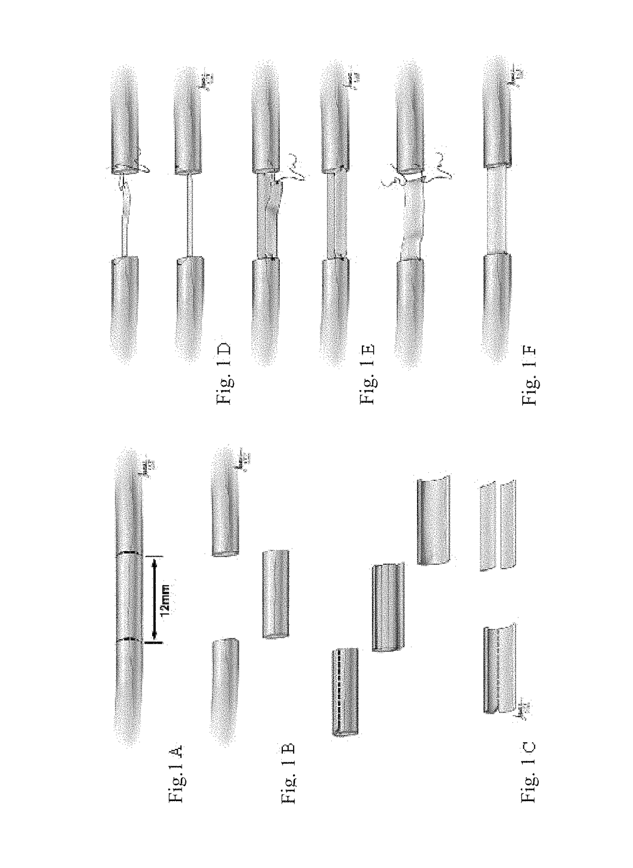 Use of epineural sheath grafts for neural regeneration and protection