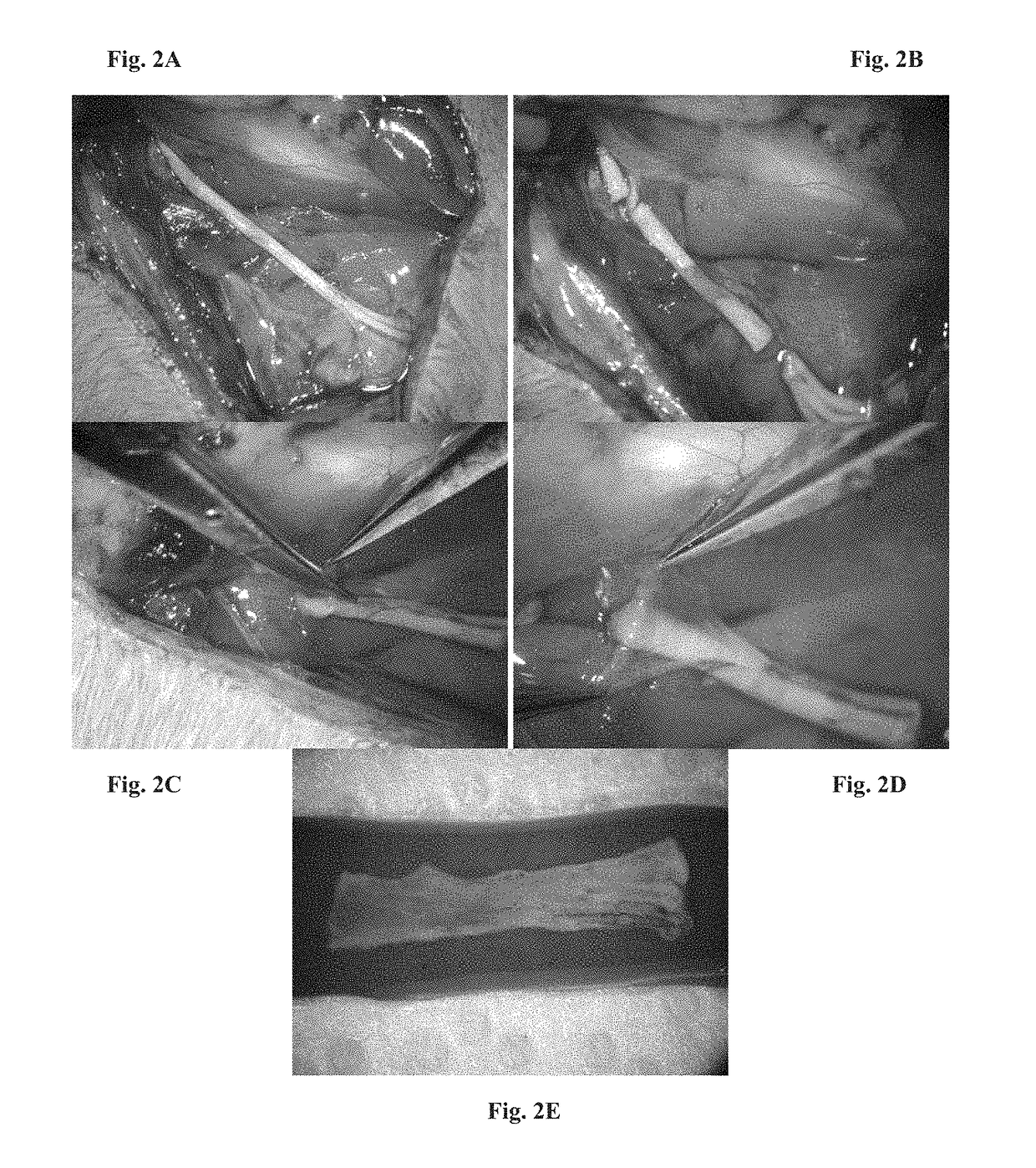 Use of epineural sheath grafts for neural regeneration and protection