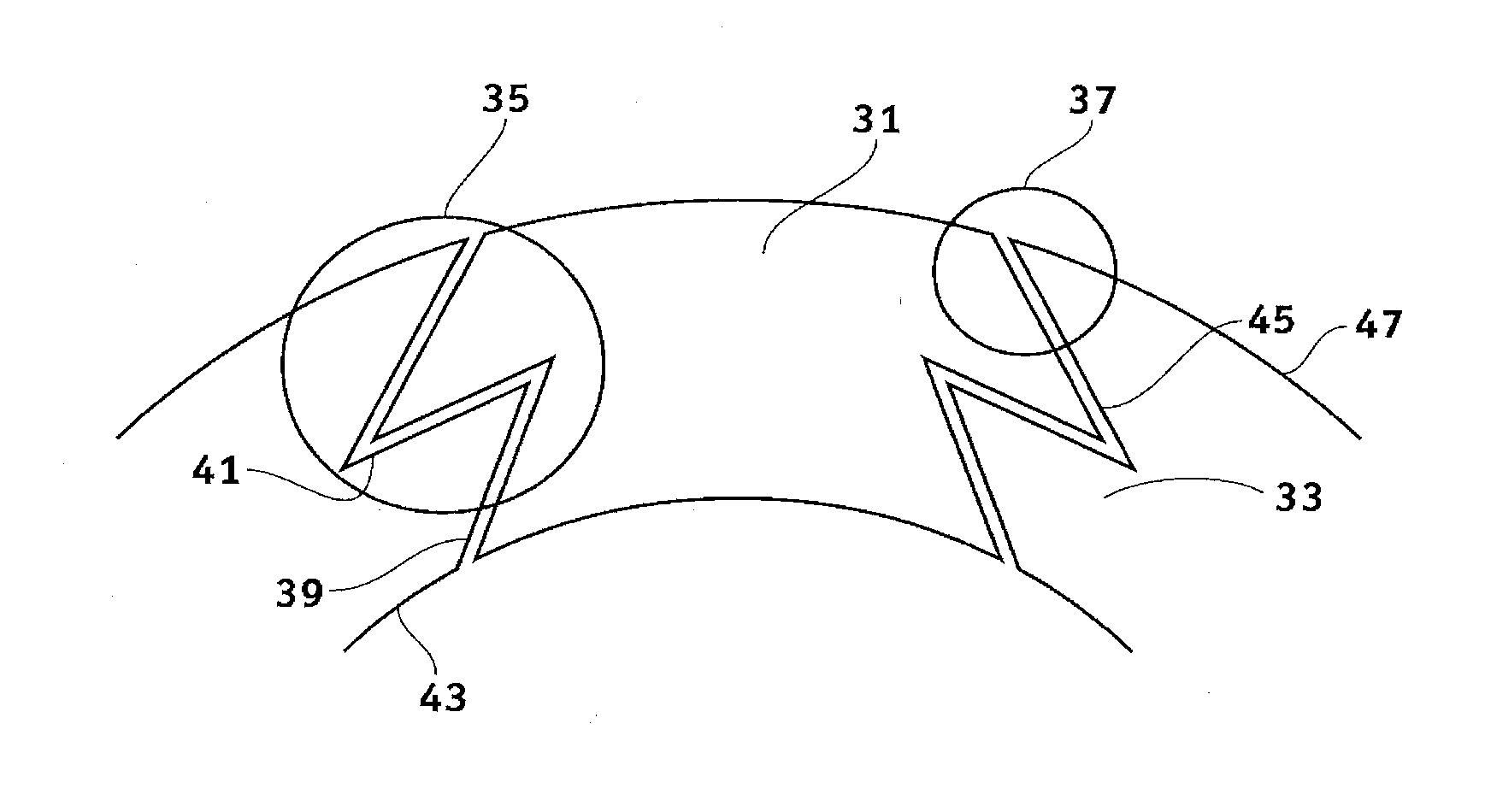 System and method for resecting corneal tissue