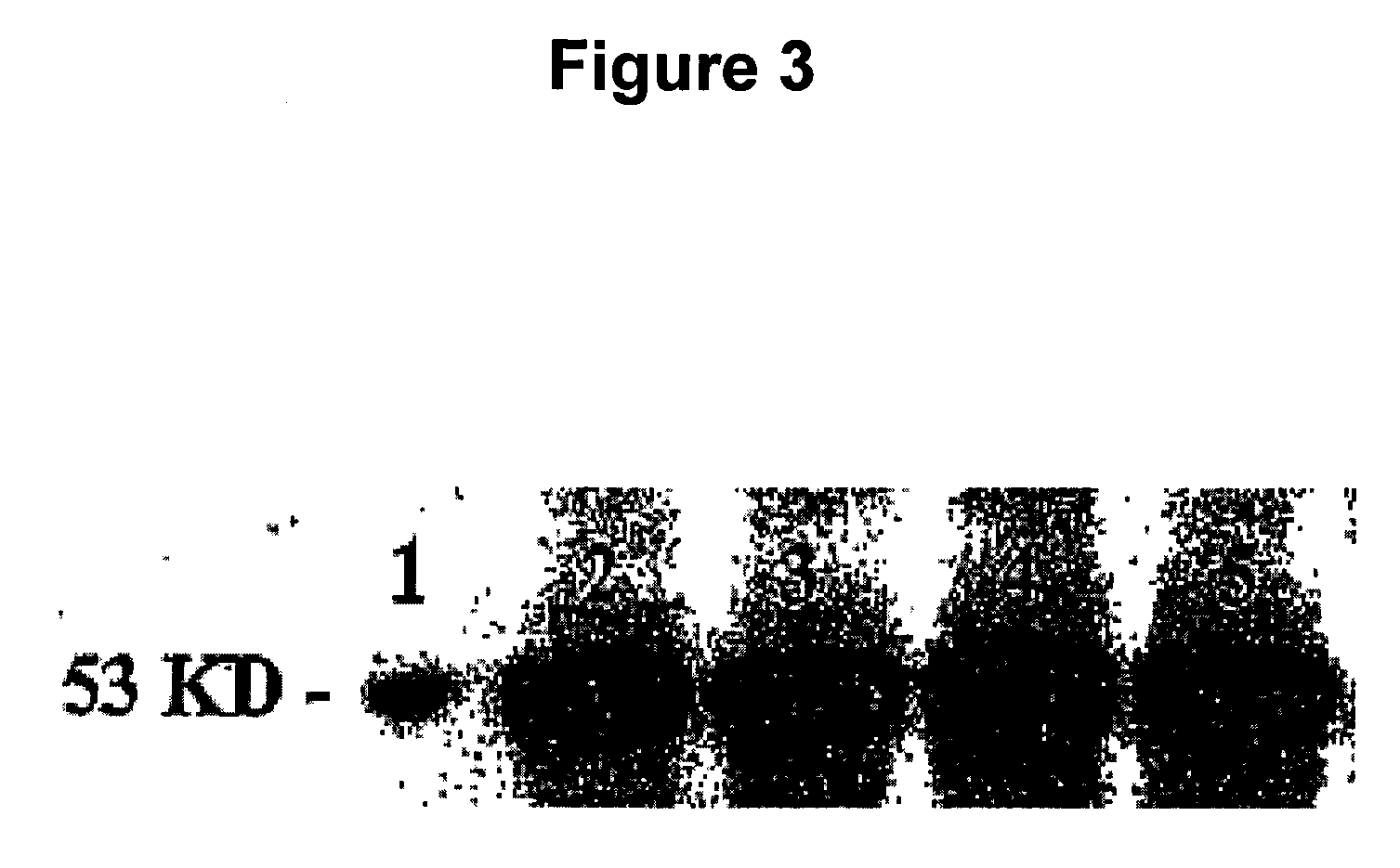 Apoptosis-Modulating Protein Therapy for Proliferative Disorders and Nanoparticles Containing the Same