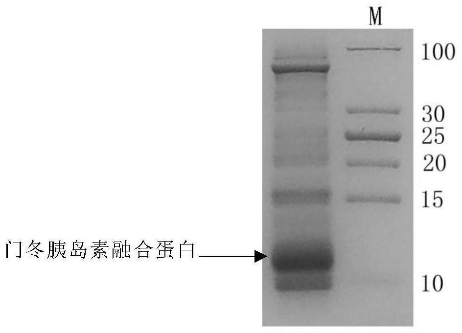 Preparation method of insulin aspart