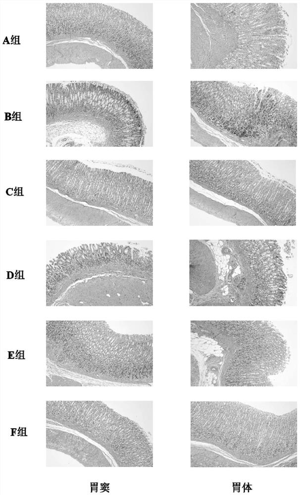 Compound traditional Chinese medicine composition for treating chronic atrophic gastritis and application