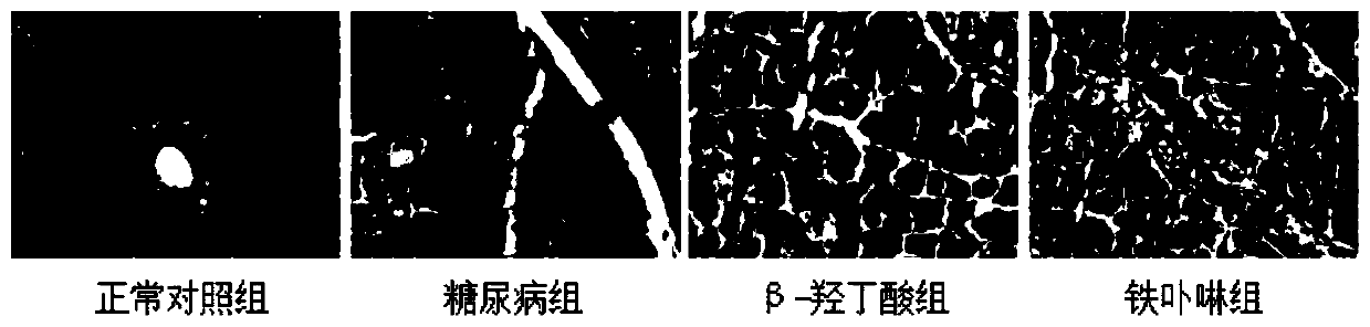 Use of beta-hydroxybutyric acid or a pharmaceutically acceptable salt thereof