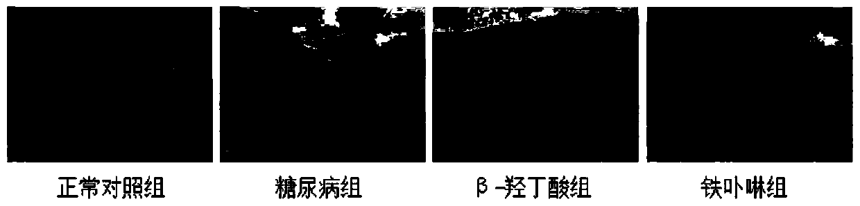 Use of beta-hydroxybutyric acid or a pharmaceutically acceptable salt thereof