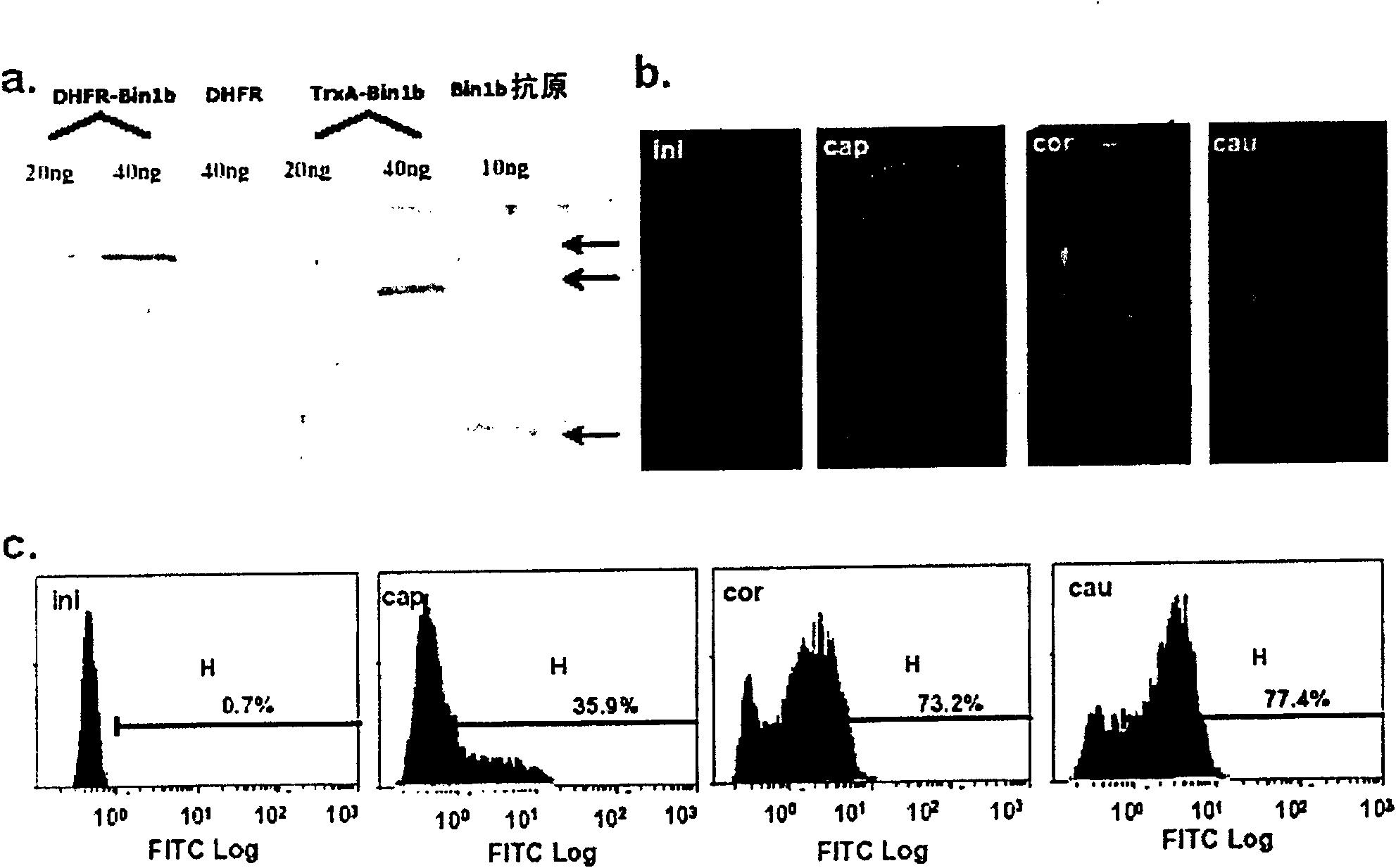 Purposes of epididymis specific antibiotic peptide Bin1b in spermiotiliosis