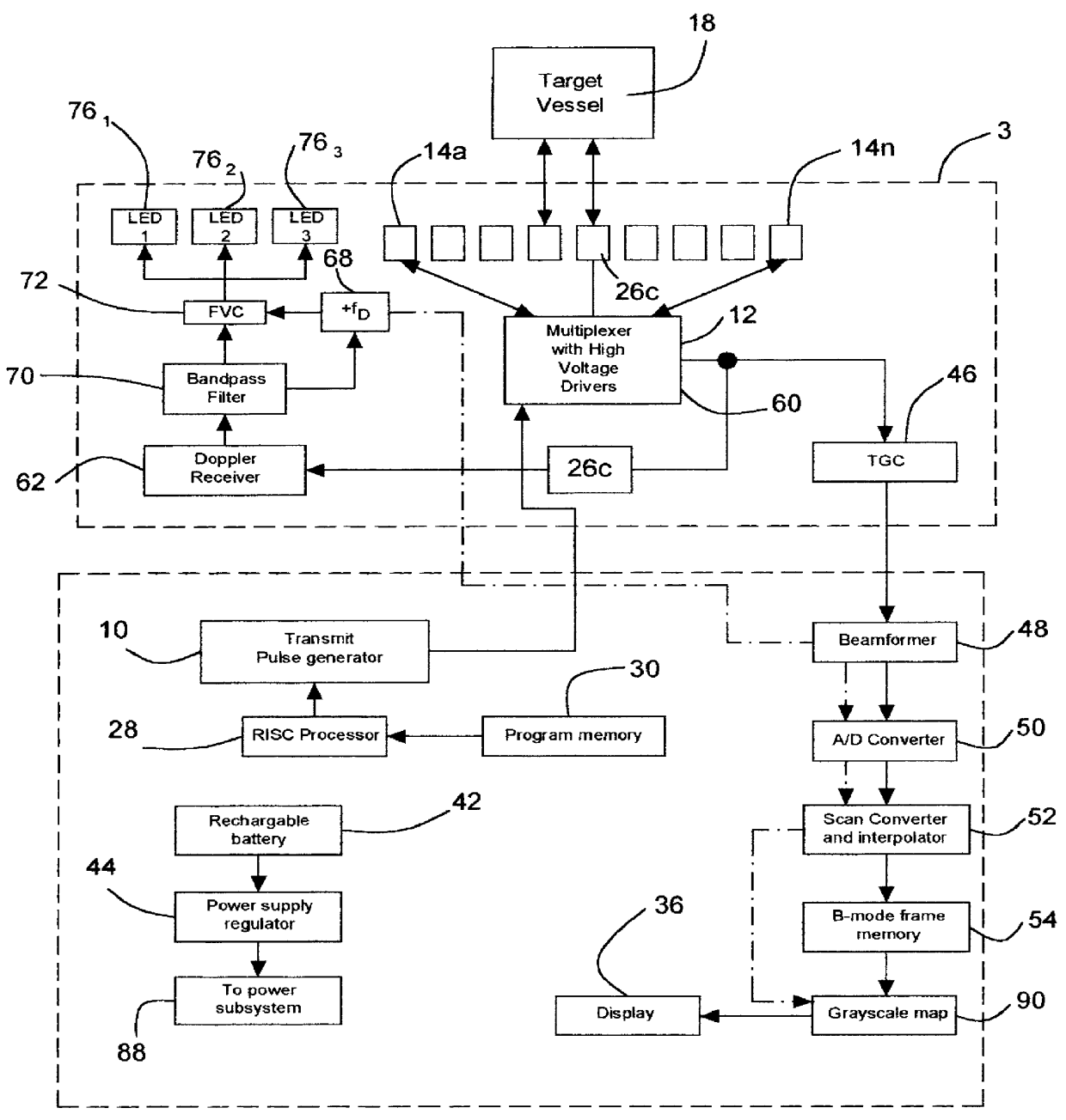 Method and apparatus for ultrasound guided intravenous cannulation