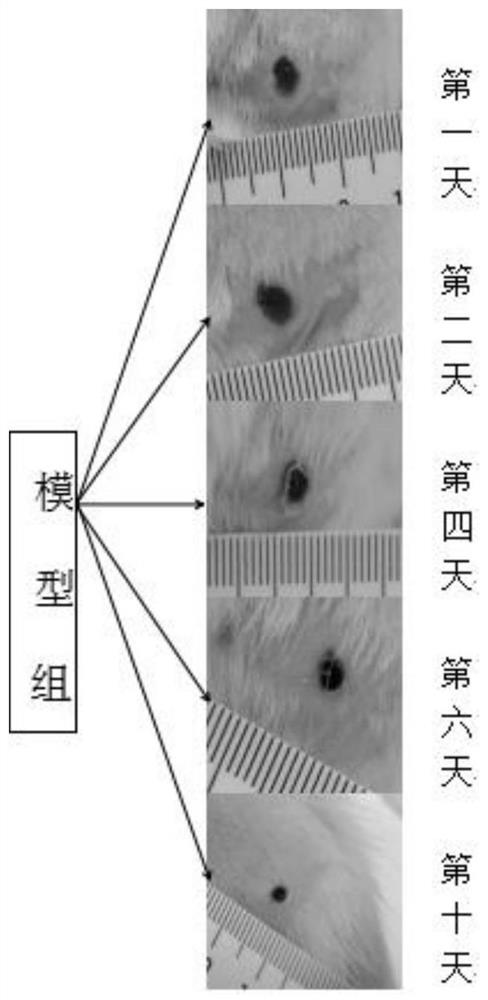 Method for treating ulcerative lesions by using marine drugs