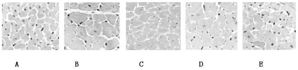 Application of Gynostemma Gynostemma Total Flavonoids in Preparation of Drugs for Preventing and Treating Myocardial Hypertrophy