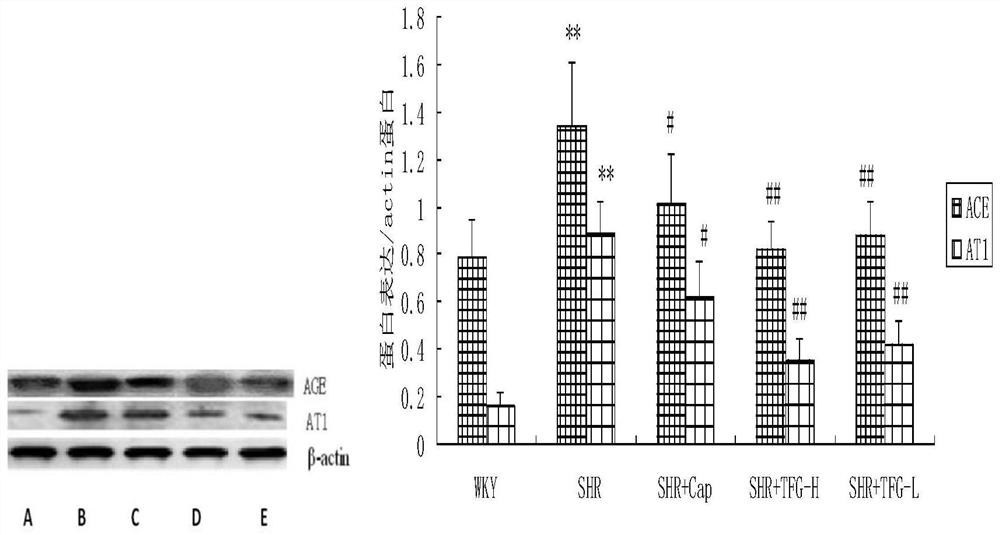 Application of Gynostemma Gynostemma Total Flavonoids in Preparation of Drugs for Preventing and Treating Myocardial Hypertrophy