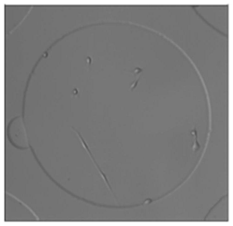 Cell instance segmentation method based on Unet and watershed algorithm